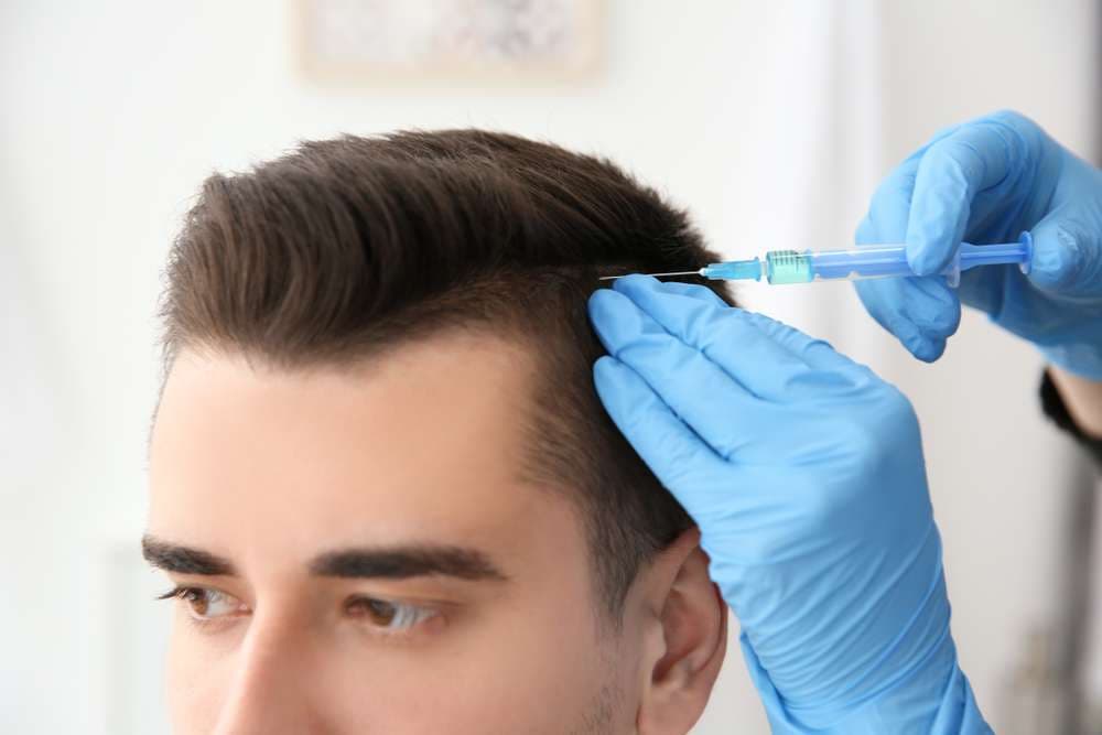 Verlorenes Haar zurückgewinnen mit Haarausfall Nürnberg