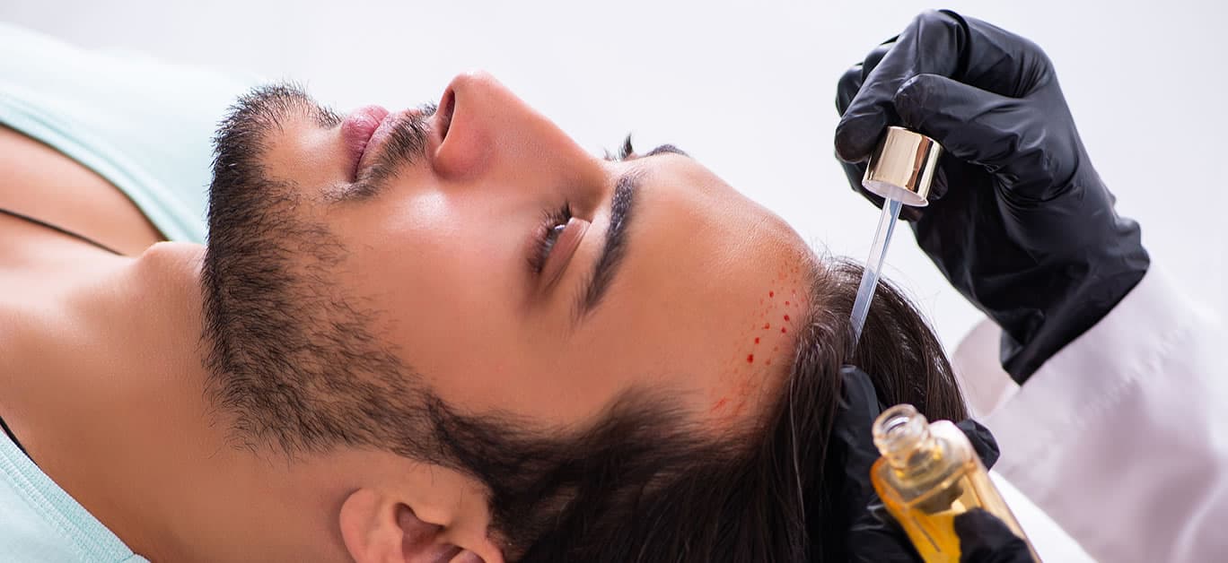 Wie man die beste Klinik in der Türkei für Haartransplantationen findet